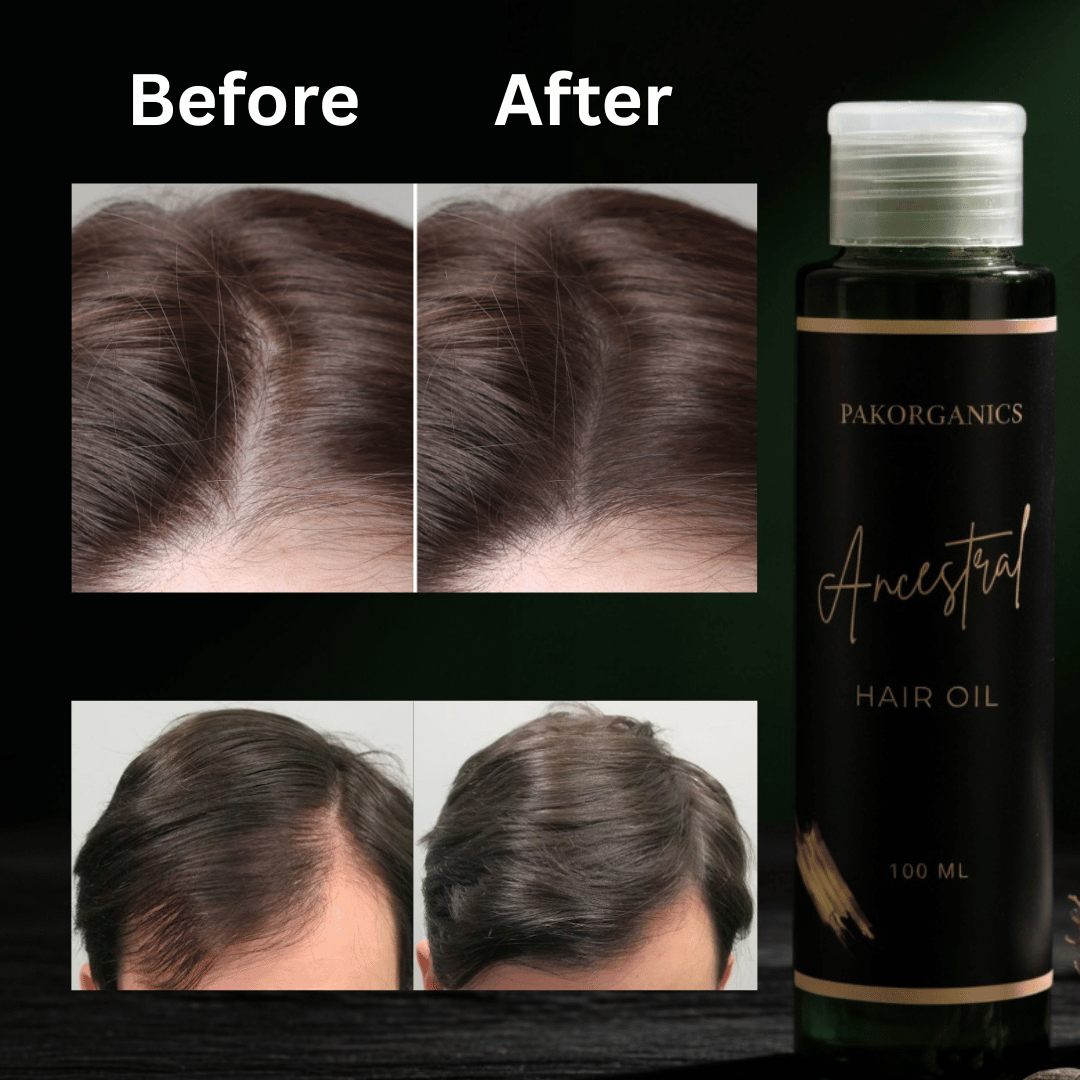 Hair Growth Oil - PakOrganics